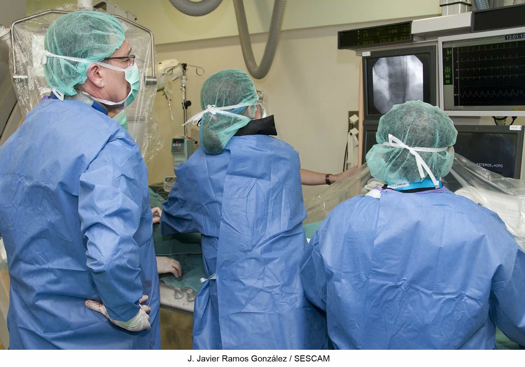 El servicio de Cardiología del Hospital Universitario de Guadalajara implanta con éxito una prótesis aórtica endovascular